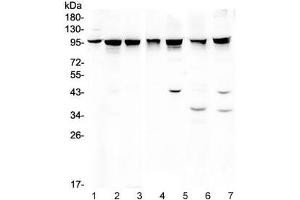 Western blot testing of 1) rat testis, 2) mouse testis, 3) human A375 and 4) human HeLa lysate wtih ALIX antibody.