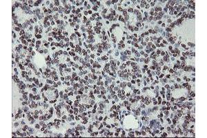 Image no. 1 for anti-Myeloid Leukemia Factor 1 (MLF1) antibody (ABIN1499493) (MLF1 antibody)