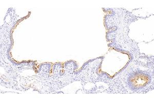 Detection of RALBP1 in Human Lung Tissue using Polyclonal Antibody to RalA Binding Protein 1 (RALBP1) (RALBP1 antibody  (AA 403-499))