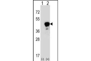 Western blot analysis of LRG1 (arrow) using rabbit polyclonal LRG1 Antibody (Center) (ABIN390660 and ABIN2840956).