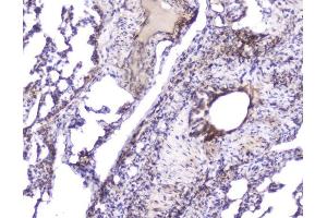 IHC analysis of Hsp27 using anti-Hsp27 antibody (ABIN6719322). (HSP27 antibody  (AA 1-209))