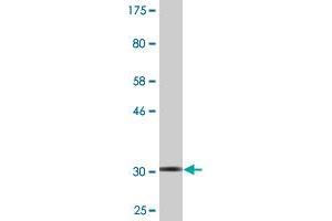 Western Blot detection against Immunogen (33. (S100P antibody  (AA 1-69))