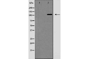 Western blot analysis of NOTCH2 (Cleaved-Ala1734) expression in Jurkat cells, treated with etoposide,The lane on the left is treated with the antigen-specific peptide. (NOTCH2 antibody)