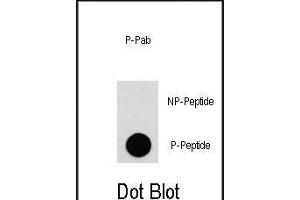 Dot blot analysis of anti-EGFR-p Phospho-specific Pab (ABIN1881285 and ABIN2850456) on nitrocellulose membrane. (EGFR antibody  (pTyr1092))