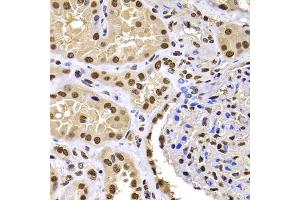 Immunohistochemistry of paraffin-embedded human kidney using HIRIP3 antibody (ABIN5974221) at dilution of 1/100 (40x lens). (HIRIP3 antibody)