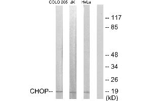 Immunohistochemistry analysis of paraffin-embedded human skeletal muscle tissue using CHOP (Ab-30) antibody. (DDIT3 antibody  (Ser30))