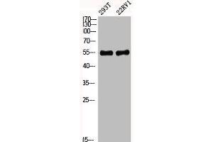 Western Blot analysis of 293T 22RV1 cells using Phospho-Akt1 (Y474) Polyclonal Antibody (AKT1 antibody  (pTyr474))