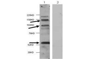 Western Blot of Rabbit anti-HDAC4 antibody. (HDAC4 antibody  (Internal Region))