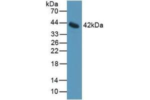 Detection of IL11Ra in Mouse Serum using Polyclonal Antibody to Interleukin 11 Receptor Alpha (IL11Ra) (IL11RA antibody  (AA 194-329))