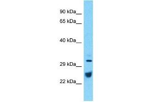 Host:  Rabbit  Target Name:  ATP1B1  Sample Type:  Thymus Tumor lysates  Antibody Dilution:  1. (ATP1B1 antibody  (C-Term))