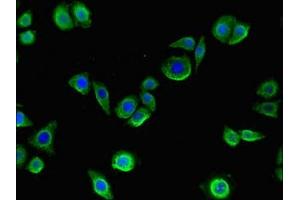 Immunofluorescent analysis of PC-3 cells using ABIN7148281 at dilution of 1:100 and Alexa Fluor 488-congugated AffiniPure Goat Anti-Rabbit IgG(H+L) (MMP13 antibody  (AA 104-471))