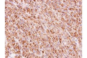 IHC-P Image Immunohistochemical analysis of paraffin-embedded U87 xenograft, using TTC30A, antibody at 1:100 dilution. (TTC30A antibody)