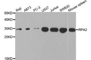 Western blot analysis of extracts of various cell lines, using RPA2 antibody. (RPA2 antibody)