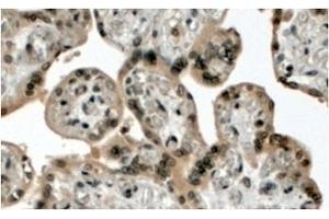 AP32078PU-N MLL2 Antibody staining of paraffin embedded Human Placenta at 4 µg/ml. (MLL2 antibody  (N-Term))