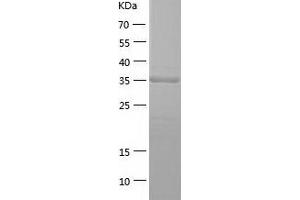 Western Blotting (WB) image for Homer Homolog 3 (Drosophila) (HOMER3) (AA 1-361) protein (His tag) (ABIN7289040) (HOMER3 Protein (AA 1-361) (His tag))