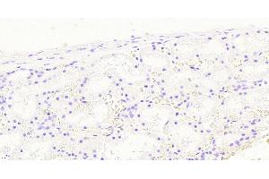 (ABIN768583) Negative Control showing staining of paraffin embedded Human Kidney, with no primary antibody.