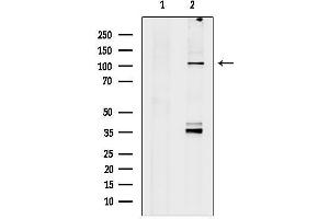 anti-Spectrin alpha 1, Erythrocytic (SPTA1) (C-Term) antibody