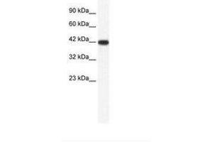 Image no. 1 for anti-Integrin-Binding Sialoprotein (IBSP) (AA 108-157) antibody (ABIN202229)
