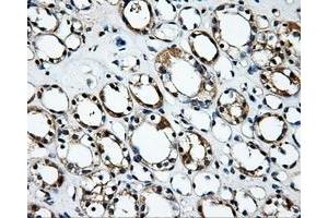 Immunohistochemical staining of paraffin-embedded Kidney tissue using anti-RALBP1mouse monoclonal antibody. (RALBP1 antibody)