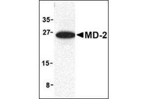 Western blot analysis of MD-2 in mouse spleen cell lysate with this product at 1 μg/ml. (LY96 antibody  (Center))