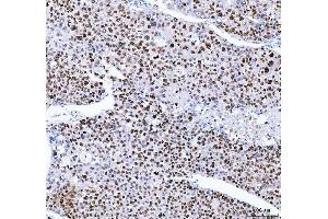IHC analysis of FEN1 using anti-FEN1 antibody (ABIN7601617).