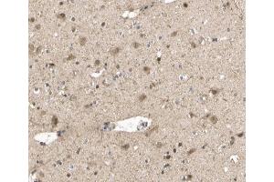 ABIN6267512 at 1/200 staining human brain tissue sections by IHC-P.