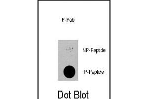 Dot blot analysis of anti-PDPK1-p Phospho-specific Pab (R) on nitrocellulose membrane.