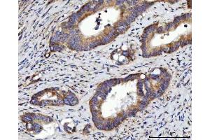 IHC analysis of RRS1 using anti-RRS1 antibody (ABIN7602918). (RRS1 antibody  (C-Term))