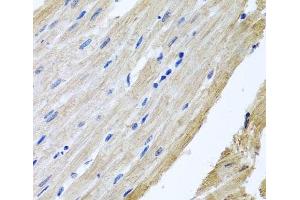 Immunohistochemistry of paraffin-embedded Rat heart using PRPH Polyclonal Antibody at dilution of 1:100 (40x lens). (Peripherin antibody)