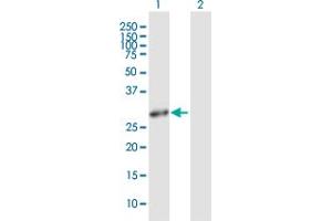 Western Blot analysis of HMOX1 expression in transfected 293T cell line by HMOX1 MaxPab polyclonal antibody. (HMOX1 antibody  (AA 1-288))