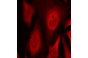 Immunofluorescence staining of methanol-fixed Hela cells using phospho-EIF2S1-S49 antibody. (EIF2S1 antibody  (pSer49))