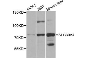 Western blot analysis of extracts of various cell lines, using SLC39A4 antibody (ABIN5971796) at 1/1000 dilution.
