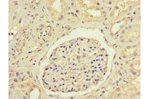 Immunohistochemistry of paraffin-embedded human kidney tissue using ABIN7144100 at dilution of 1:100 (ANGPTL1 antibody  (AA 24-289))