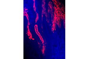 human sole (courtesy of L. (KRT16 antibody)