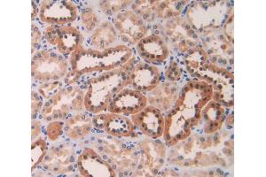 IHC-P analysis of kidney tissue, with DAB staining. (LOXL4 antibody  (AA 399-552))