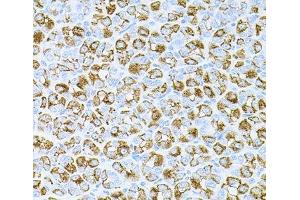 Immunohistochemistry of paraffin-embedded Mouse stomach using DLK1 Polyclonal Antibody at dilution of 1:100 (40x lens). (DLK1 antibody)