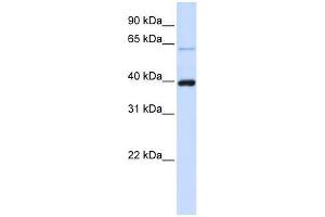 PHF6 antibody used at 0. (PHF6 antibody  (C-Term))