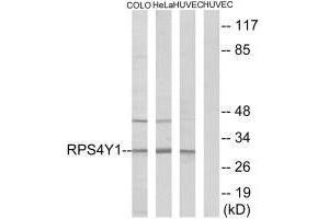 RPS4Y1 抗体  (C-Term)