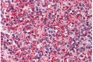 Human Spleen (formalin-fixed, paraffin-embedded) stained with KIAA1303 antibody ABIN214505 at 2. (Raptor antibody)