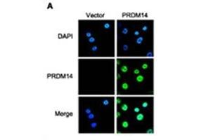 IFanalysis of PRDM14 in breast cancer cells. (PRDM14 antibody  (N-Term))