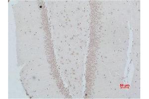 Immunohistochemistry (IHC) analysis of paraffin-embedded Rat Brain Tissue using NMBR Polyclonal Antibody. (NMBR antibody)