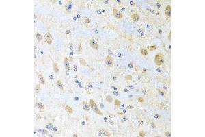 Immunohistochemistry of paraffin-embedded mouse brain using MLN antibody at dilution of 1:100 (40x lens).