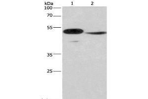 Western Blot analysis of Mouse panceas tissue and NIH/3T3 cell using IRF9 Polyclonal Antibody at dilution of 1:380 (IRF9 antibody)