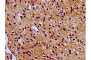 IHC image of ABIN7171107 diluted at 1:300 and staining in paraffin-embedded human glioma performed on a Leica BondTM system. (SV2C antibody  (AA 459-524))