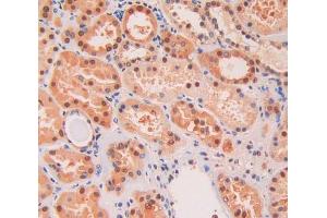 IHC-P analysis of kidney tissue, with DAB staining. (KIF5A antibody  (AA 473-605))