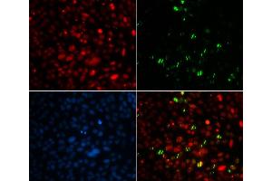 Immunofluorescence (IF) image for anti-Centrin, EF-Hand Protein, 2 (CETN2) antibody (ABIN1876585) (CETN2 antibody)