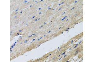 Immunohistochemistry of paraffin-embedded Rat heart using FECH Polyclonal Antibody at dilution of 1:100 (40x lens). (FECH antibody)