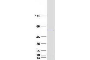 Validation with Western Blot