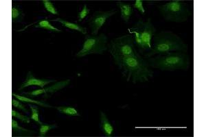 Immunofluorescence of purified MaxPab antibody to APOBEC2 on HeLa cell.