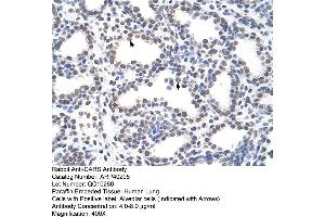 Rabbit Anti-CARS Antibody  Paraffin Embedded Tissue: Human Lung Cellular Data: Alveolar cells Antibody Concentration: 4. (CARS antibody  (C-Term))